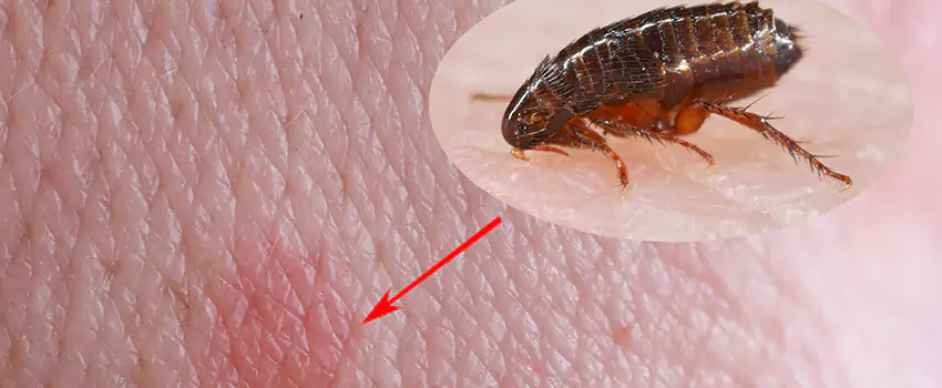 Flea Control for Humans Norwalk, CA